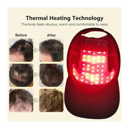 Vechella Light Therapy Growth Cap