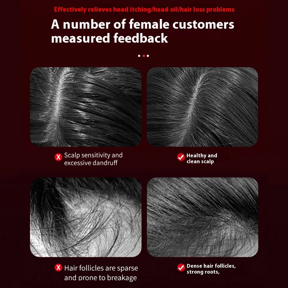 Vechella™ Hair Growth Massager