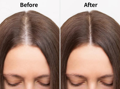 Vechella Hair Growth Massager