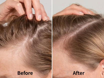 Vechella Hair Growth Massager